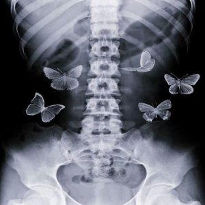mariposas_en_el_estomago